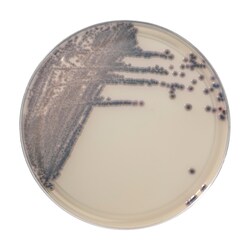 Thermo Scientific Spectra Candida Agar 90 mm plate | Buy Online | Thermo Scientific&trade; | Fisher Scientific